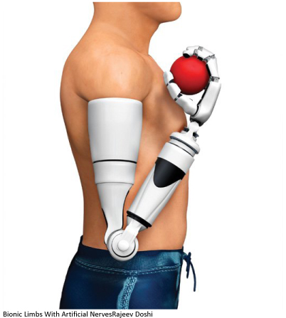 Bionic Arm
